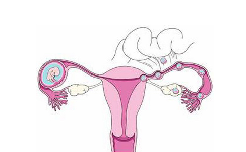 女性子宫内膜薄怎么办?快补充天然雌激素
